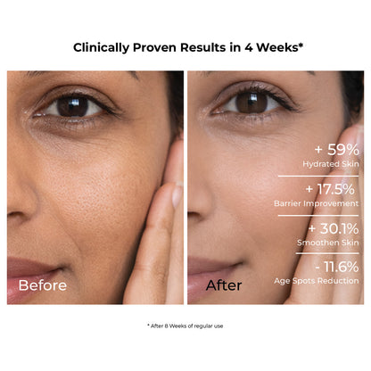 0.3% Retinol Anti Aging Face Serum. Clinically Proven.