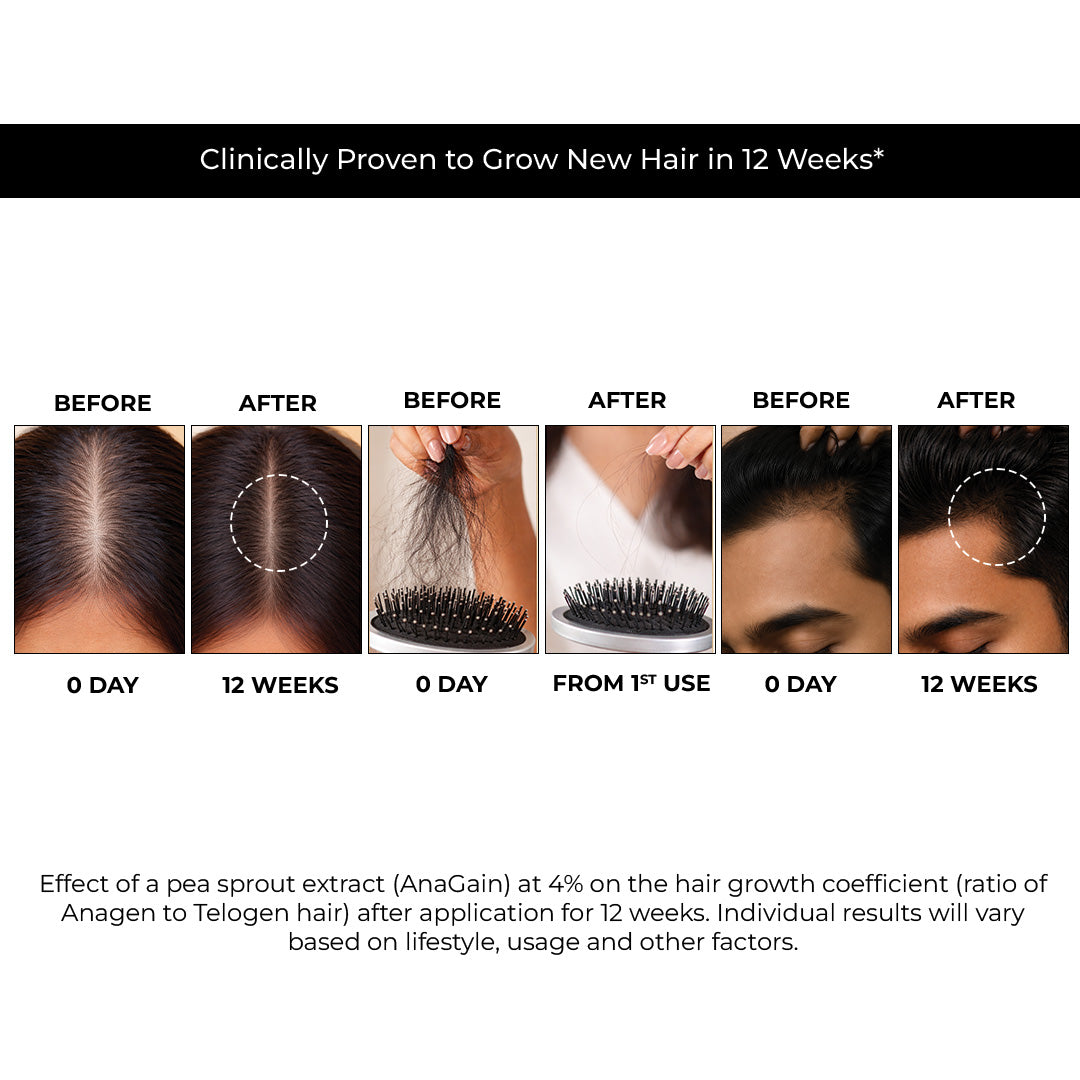 Hair Growth and Anti Hairfall Serum. 21% Actives. In Vitro Tested.