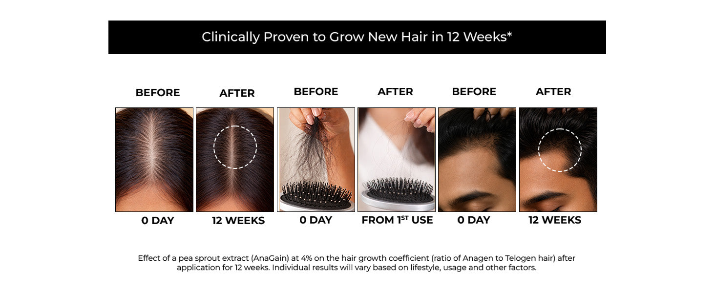Hair Growth and Anti Hairfall Serum. 21% Actives. In Vitro Tested.